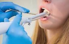 Лечение Тонзиллор в Новосибирске в медицинском центре Инфо-Медика